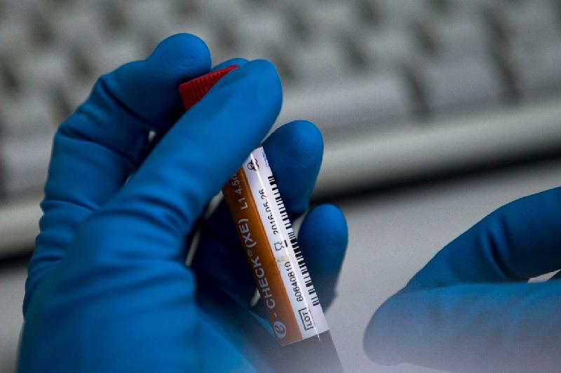 Қазақстандық спортшылар допинг дауына ілінді