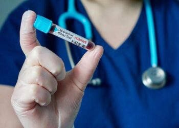 Шымкентте бір тәулікте 60 адам коронавирус жұқтырған