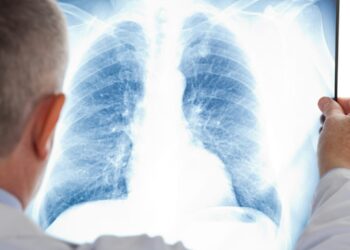 Түркістан: Пневмониядан 198 науқас жазылып шықты