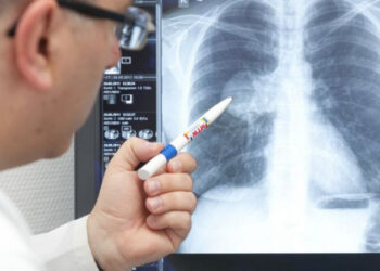 Дәрігер пневмония кезінде не істеуге болмайтынын айтты