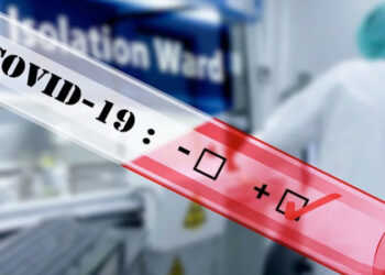 Шымкентте өткен тәулікте 19 адамнан коронавирус анықталды