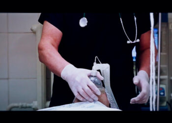 Шымкент: Алғаш рет жасанды буын қою отасы жасалды