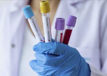 Шымкентте коронавирустан 23 адам емделіп шықты