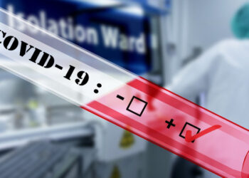 Түркістан облысында  індетті жұқтыру көрсеткіші төмендеді