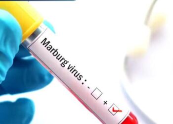 МИНИСТРЛІК МАРБУРГ ВИРУСЫ ТУРАЛЫ ЕСКЕРТУІНЕ БАЙЛАНЫСТЫ БАҚЫЛАУДЫ КҮШЕЙТУДЕ